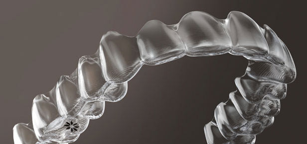 watch invisalign video