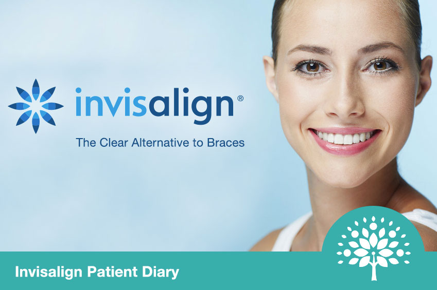 Invisalign Image of Woman Smiling